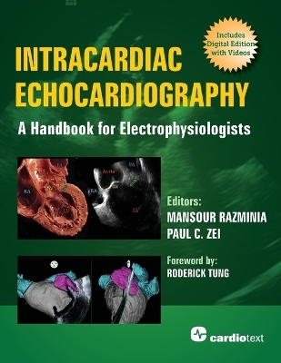 Intracardiac Echocardiography: A Handbook for Electrophysiologists - 