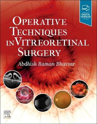 Operative Techniques in Vitreoretinal Surgery - 