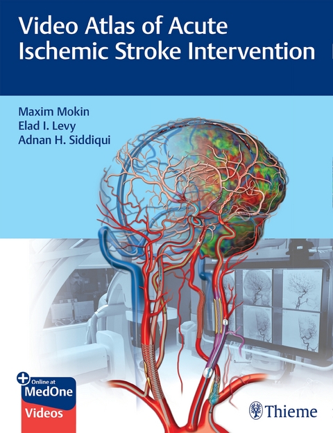 Video Atlas of Acute Ischemic Stroke Intervention - Maxim Mokin, Elad Levy, Adnan Siddiqui