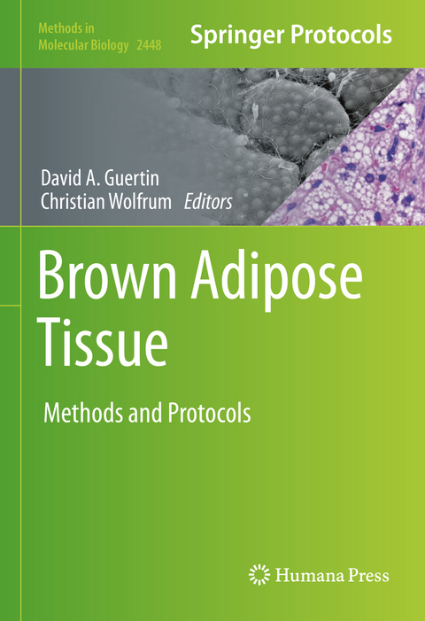 Brown Adipose Tissue - 