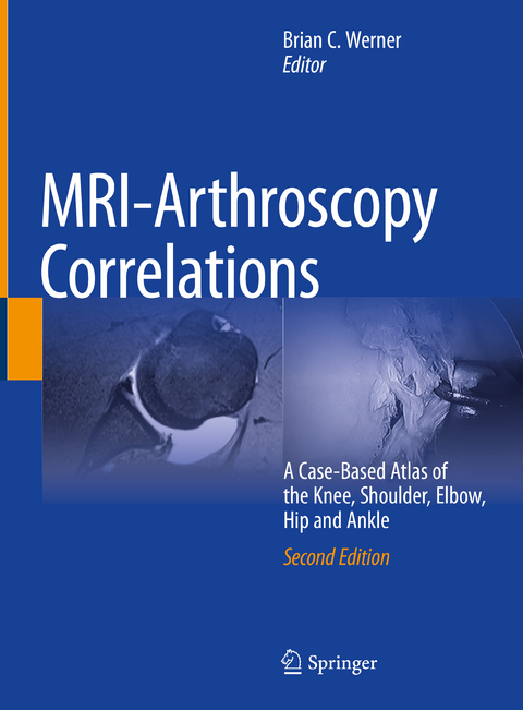 MRI-Arthroscopy Correlations - 