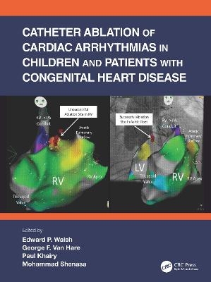 Catheter Ablation of Cardiac Arrhythmias in Children and Patients with Congenital Heart Disease - 