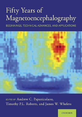 Fifty Years of Magnetoencephalography - 