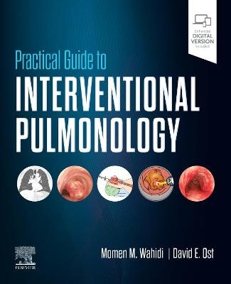 Practical Guide to Interventional Pulmonology - 