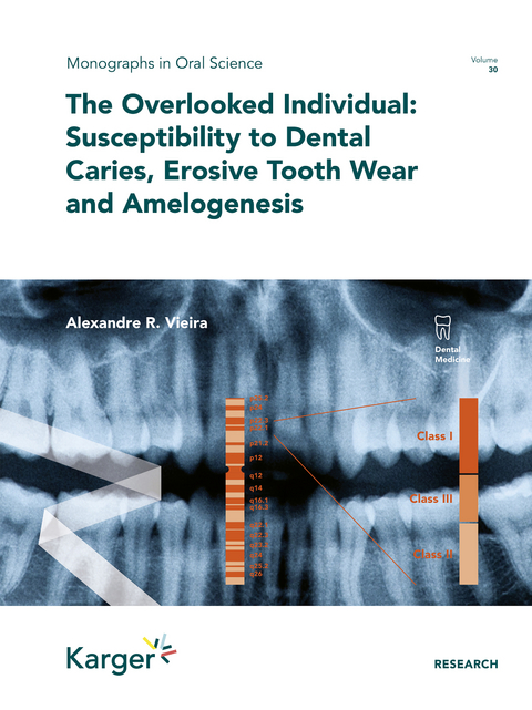 The Overlooked Individual: Susceptibility to Dental Caries, Erosive Tooth Wear and Amelogenesis - Alexandre Rezende Vieira