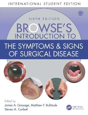 Browse's Introduction to the Symptoms & Signs of Surgical Disease - 