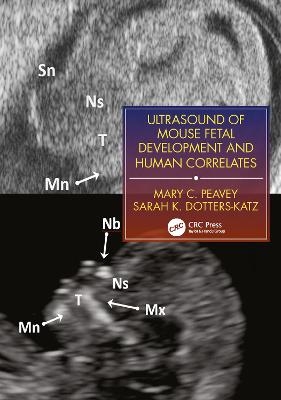 Ultrasound of Mouse Fetal Development and Human Correlates - Mary C. Peavey, Sarah K. Dotters-Katz