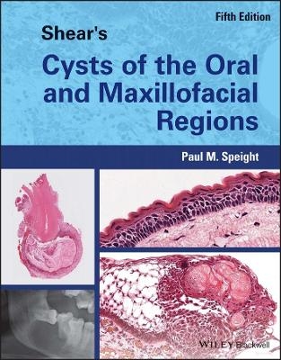 Shear's Cysts of the Oral and Maxillofacial Regions - Paul M. Speight