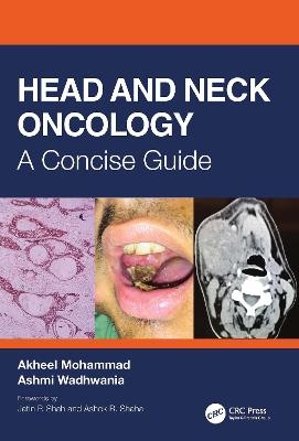Head and Neck Oncology - Akheel Mohammad