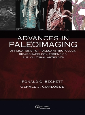 Advances in Paleoimaging - Gerald J. Conlogue, Ronald G. Beckett