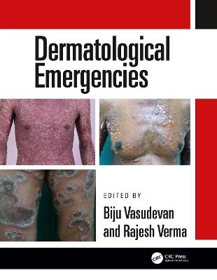 Dermatological Emergencies - 