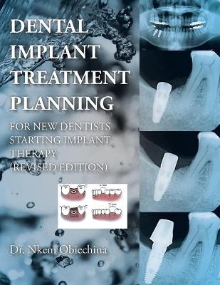 Dental Implant Treatment Planning for New Dentists Starting Implant Therapy - Dr Nkem Obiechina