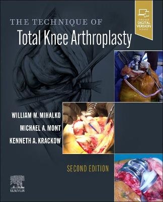 The Technique of Total Knee Arthroplasty - 