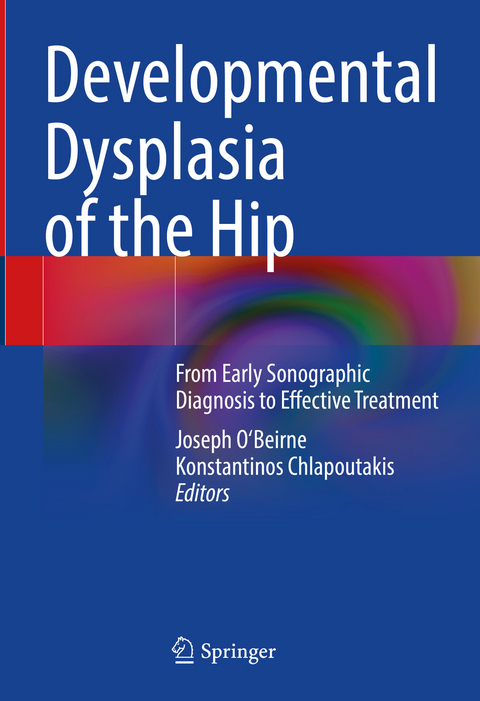 Developmental Dysplasia of the Hip - 