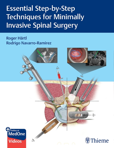 Essential Step-By-Step Techniques for Minimally Invasive Spinal Surgery - Roger Härtl, Rodrigo Navarro-Ramirez