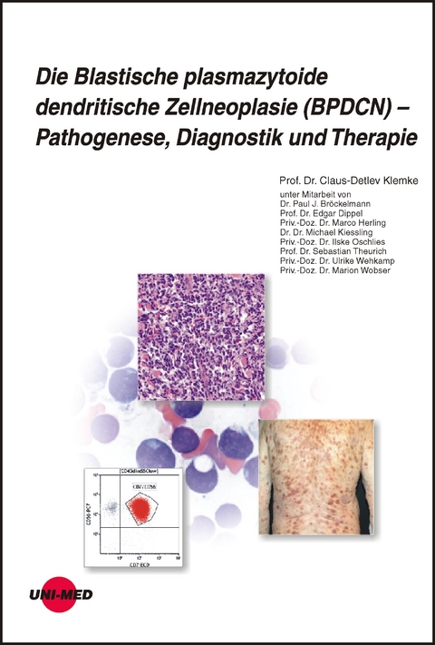 Die Blastische plasmazytoide dendritische Zellneoplasie (BPDCN) – Pathogenese, Diagnostik und Therapie - Claus-Detlev Klemke