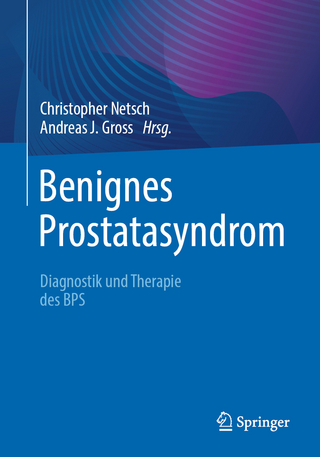 Benignes Prostatasyndrom - Christopher Netsch; Andreas J. Gross