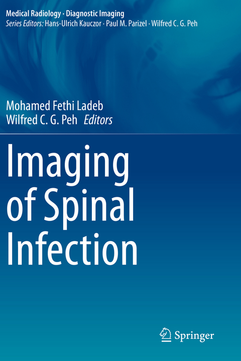 Imaging of Spinal Infection - 