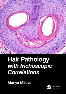 Hair Pathology with Trichoscopic Correlations - Mariya Miteva