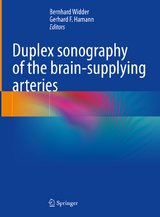Duplex sonography of the brain-supplying arteries - 