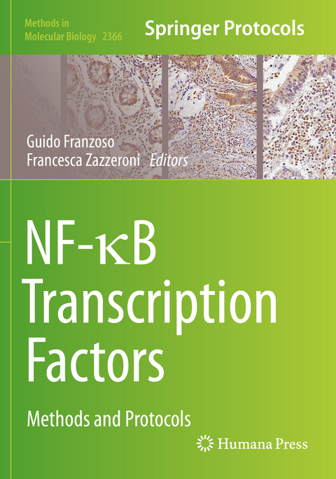 NF-κB Transcription Factors - 