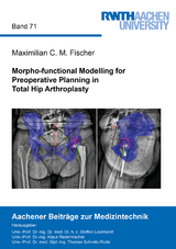 Morpho-functional Modelling for Preoperative Planning in Total Hip Arthroplasty - Maximilian C. M. Fischer