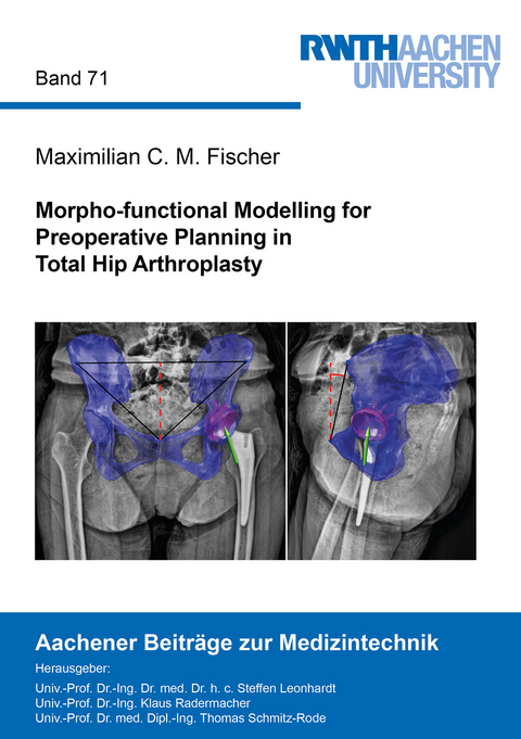 Morpho-functional Modelling for Preoperative Planning in Total Hip Arthroplasty - Maximilian C. M. Fischer