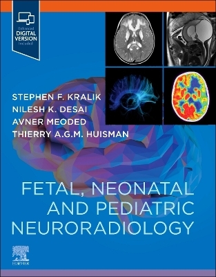 Fetal, Neonatal and Pediatric Neuroradiology - Stephen Kralik, Nilesh Desai, Avner Meoded, Thierry A. G. M. Huisman