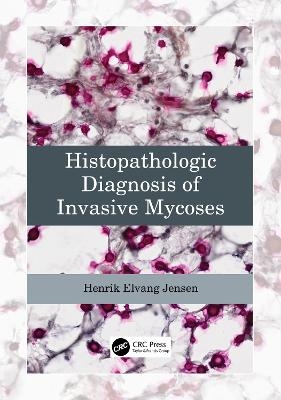 Histopathologic Diagnosis of Invasive Mycoses - Henrik Elvang Jensen