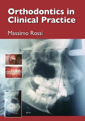 Orthodontics in Clinical Practice - Dr Massimo Rossi