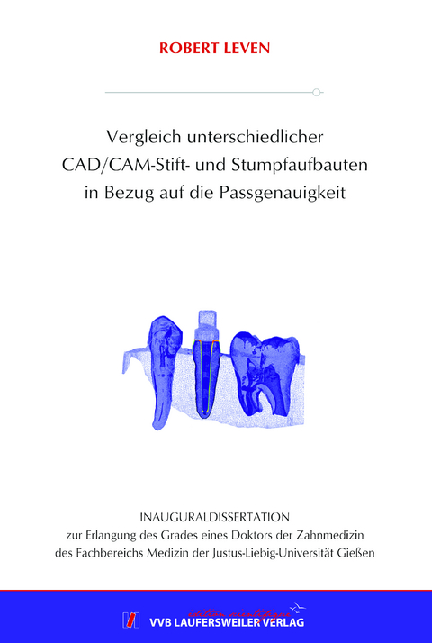 Vergleich unterschiedlicher CAD/CAM-Stift- und Stumpfaufbauten in Bezug auf die Passgenauigkeit - Robert Leven