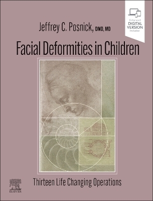 Facial Deformities in Children - Jeffrey C. Posnick