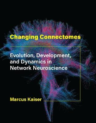 Changing Connectomes - Marcus Kaiser