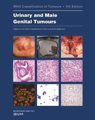 WHO classification of tumours of the urinary system and male genital organs -  International Agency for Research on Cancer