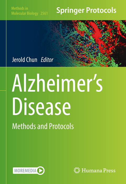 Alzheimer’s Disease - 