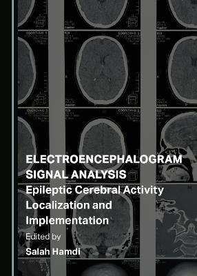 Electroencephalogram Signal Analysis - 