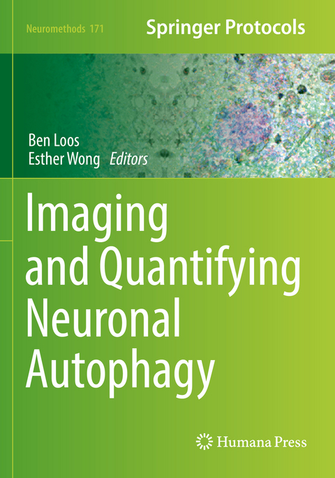 Imaging and Quantifying Neuronal Autophagy - 