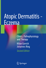 Atopic Dermatitis - Eczema - Eyerich, Kilian; Ring, Johannes