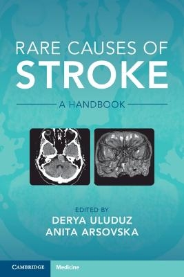 Rare Causes of Stroke - Anita Arsovska