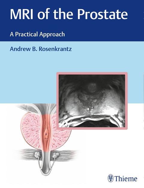 MRI of the Prostate - Andrew B Rosenkrantz