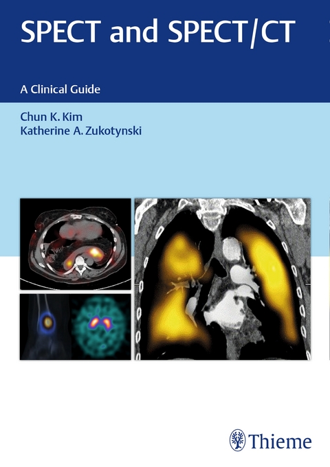 Spect and Spect/CT