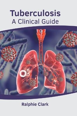 Tuberculosis: A Clinical Guide - 