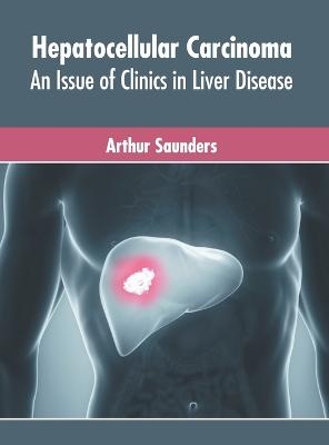 Hepatocellular Carcinoma: An Issue of Clinics in Liver Disease - 