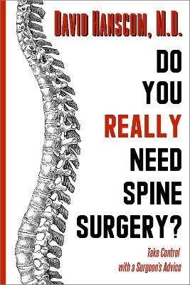 Do You Really Need Spine Surgery? - Dr. David Hanscom