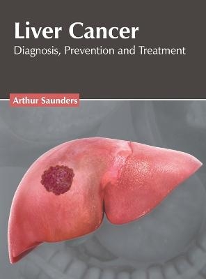 Liver Cancer: Diagnosis, Prevention and Treatment - 