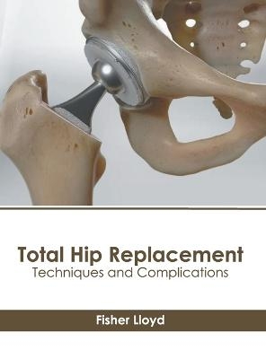 Total Hip Replacement: Techniques and Complications - 