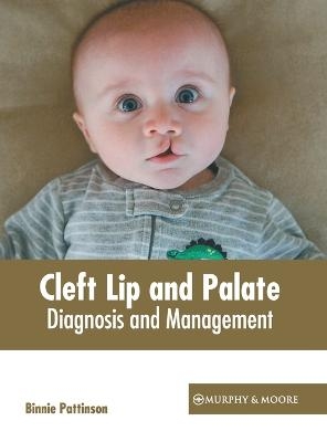 Cleft Lip and Palate: Diagnosis and Management - 