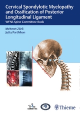 Cervical Spondylotic Myelopathy and Ossification of Posterior Longitudinal Ligament - 