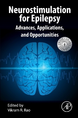 Neurostimulation for Epilepsy - 