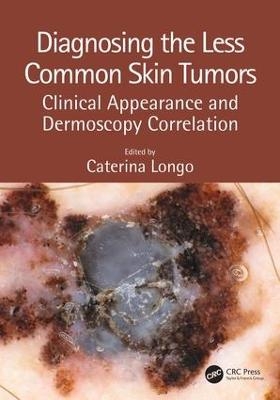 Diagnosing the Less Common Skin Tumors - 